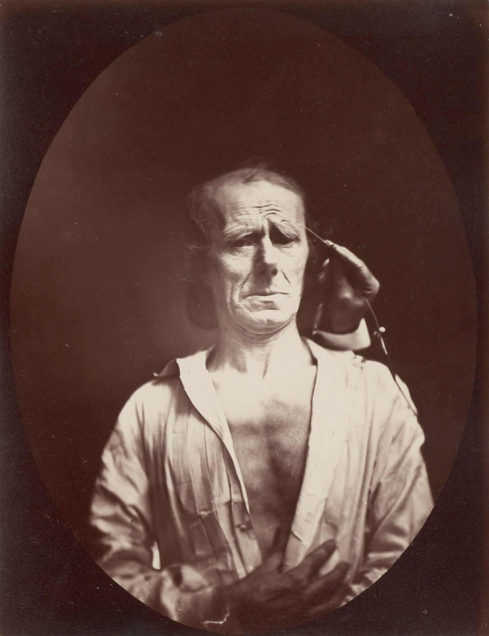 Duchenne de Boulogne and Adrien Tournachon