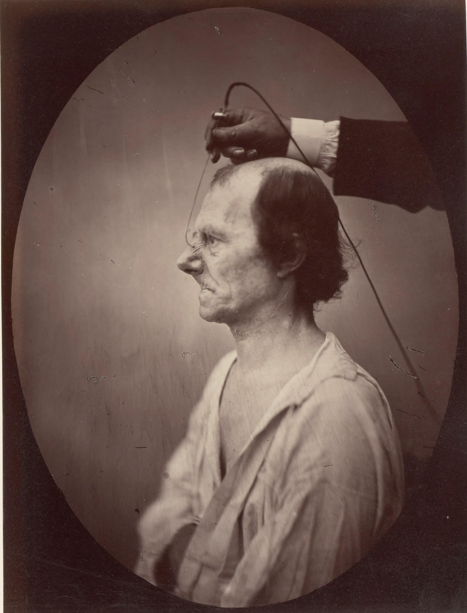 Duchenne de Boulogne and Adrien Tournachon